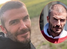 Becks đầu đầy tóc trở lại