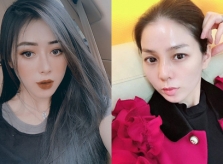 Những mỹ nhân Việt gặp biến chứng vì thẩm mỹ hỏng