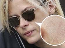 7 thói quen gây bít tắc lỗ chân lông