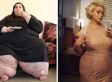 Gái Mỹ 'lột xác' sau khi giảm 181 kg