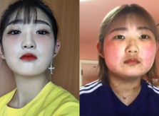 Con gái Choi Jin Sil tăng 10 kg vì bệnh Lupus