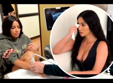 Kim Kardashian mắc bệnh lupus