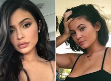 Kylie Jenner thừa nhận rút hết filler, trả lại vẻ tự nhiên cho đôi môi