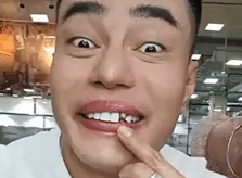 Lê Dương Bảo Lâm bị rơi răng sứ khi đang livestream