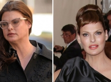 Siêu mẫu Linda Evangelista bị biến dạng vì thẩm mỹ