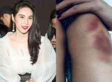 Thủy Tiên bị ngã gây chấn thương trong lúc luyện tập