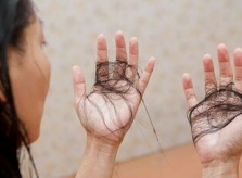 7 cách kiểm tra tình trạng tóc rụng