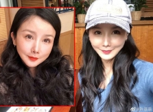 Tôn Phi Phi sau nhiều năm 'dao kéo'