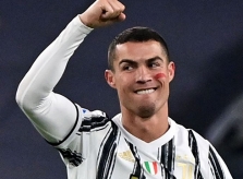 Ý nghĩa vệt đỏ trên má các sao Serie A