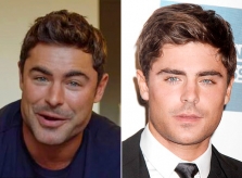 Bạn thân phủ nhận diện mạo Zac Efron thay đổi vì 'dao kéo'